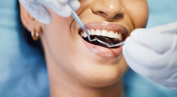 Best Emergency Root Canal Treatment in Comstock Park, MI